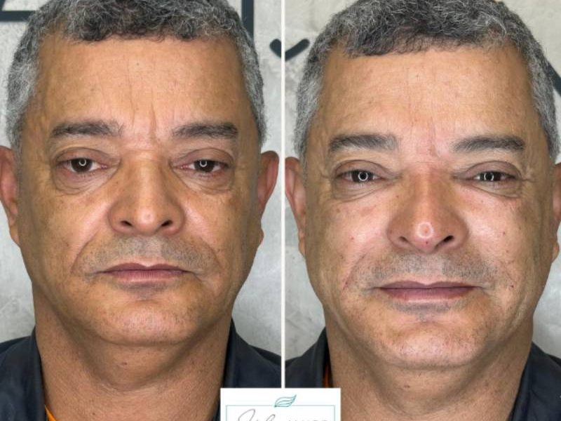 Imagem do WhatsApp de 2025-07-21 à(s) 11.17.08_f73dfac6 (1)